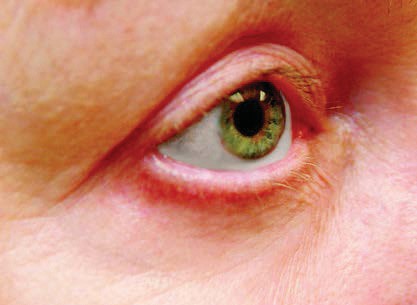PM Anti-Aging Eye Cream — Week 8